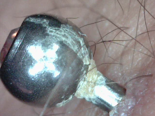 croutes bijou piercing